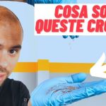 Svelato il mistero della perdita di acqua a motore spento: ecco come risolvere il problema!